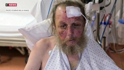 Antibes : Marc, 55 ans, tabassé gratuitement par trois individus