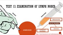 How to examine the lymph nodes? #lymphnodes #lymphology