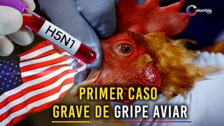 Urgente: Caso GRAVE de Gripe Aviar en EEUU. ¿Hay riesgo de contagio?