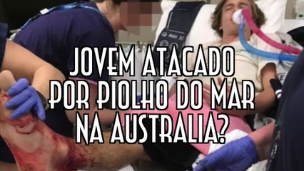 Jovem atacado por piolho do mar na Australia? - EMVB - Emerson Martins Video Blog 2017