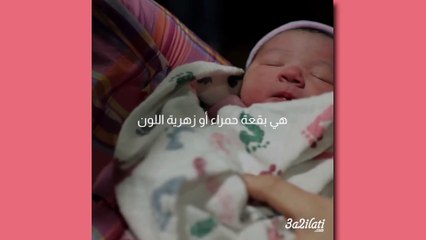 بالفيديو، 7 علامات طبيعية على جسم طفلك لا تقلقي حيالها