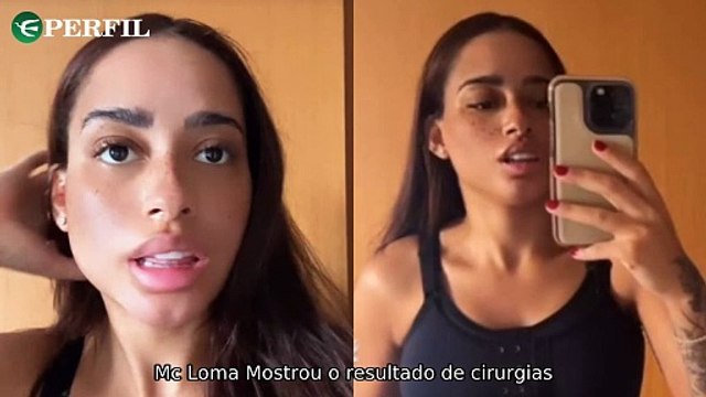 MC Loma revela segredos: lipo HD, silicone, sexualidade escondida e ultrassom inusitado do filho.