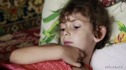 Da Almirall nuovo anticorpo monoclonale contro dermatite atopica