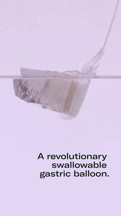 🚀 Gastric Balloon Insertion – Non-Surgical Weight Loss! ⚖️ | Ugale Bariatrics