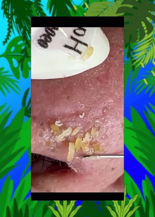 Scalp Spa Treatment for Healthy Hair Growth (ASMR)