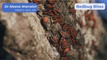 Bedbug Nightmare Here’s How to Get Rid of Them for Good!