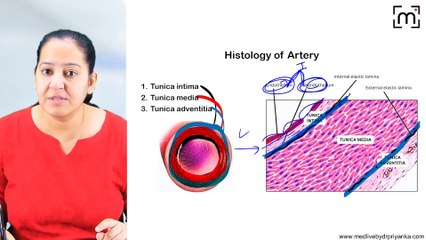 1. Atherosclerosis