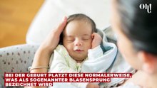 Verblüffend: Mutter erlebt seltenes Phänomen bei Geburt ihres Babys (1)