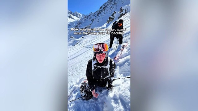 Skier breaks nose while attempting backflip