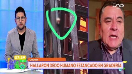 Dedo Oruro
