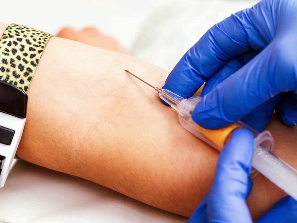 Varicose veins in Hindi, varicose vein pain, varicose vein pain relief,