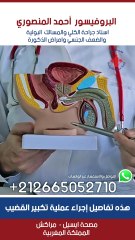 هذه تفاصيل إجراء عملية تكبير القضيب