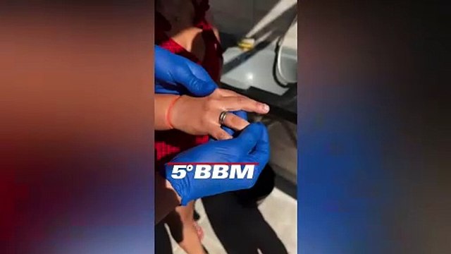 Em Cajazeiras, mulher solicita Corpo de Bombeiros para retirar dois anéis de um de seus dedos