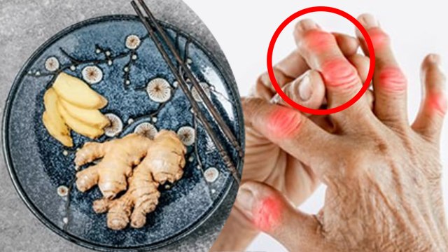 Ginger For Arthritis :अदरक से गठिया ठीक होता है क्या, Gathiya Me Adrak Ke Fayde Hai...