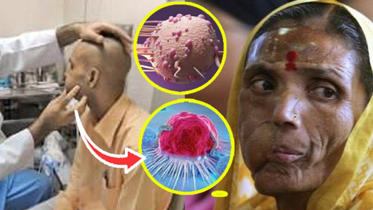 Difference Between Tumor And Cancer: कैंसर और ट्यूमर में क्या अंतर होता है | Boldsky