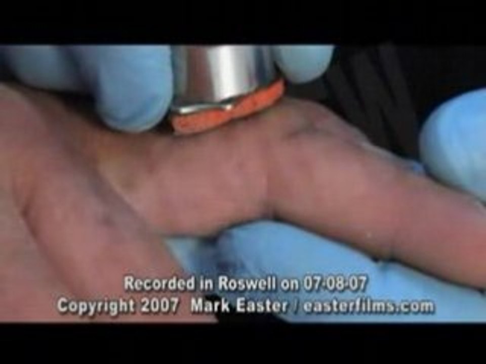 alien implant