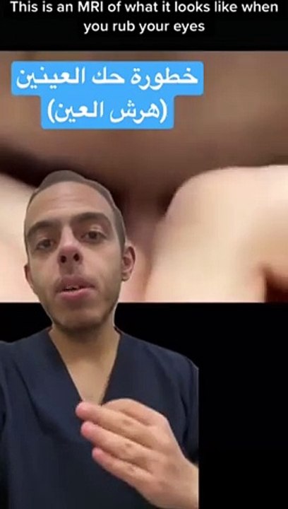 خطورة حك العينين _medicine _طب _shorts(360P)(480P)