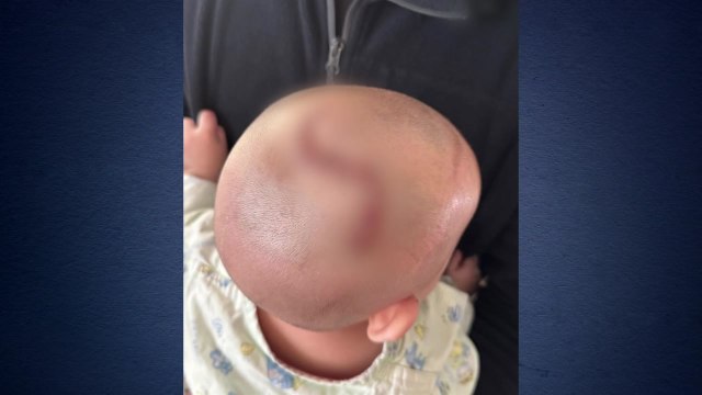 휴대전화 던져 10개월 아기 중상 입힌 20대 구속 / YTN