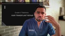 Hair Transplant in Pune _ Best Hair Transplant Results and Cost of Hair Transplant in Pune