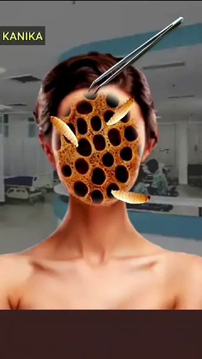 Girl face holes removing maggot's animation #asmr #asmrsounds