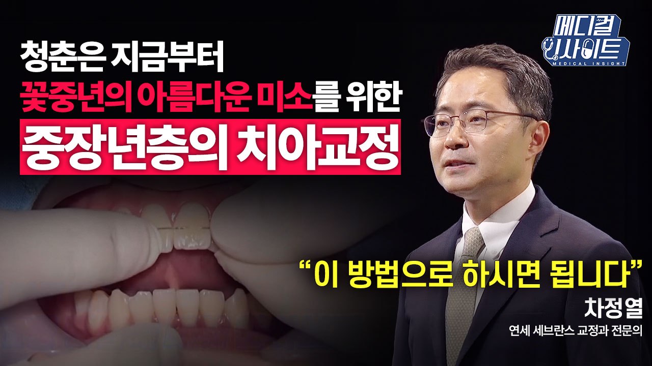 [메디컬 인사이트 64회] 교정과 전문의가 알려주는 중장년층의 치아 교정법 / YTN