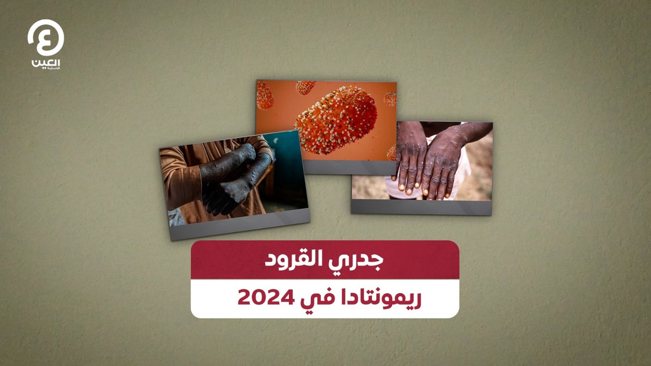 جدري القرود ريمونتادا في 2024