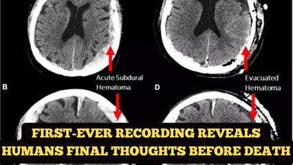 First-Ever Recording Reveals Humans Final Thoughts Before Death