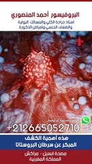 هذه أهمية الكشف  المبكر عن سرطان البروستاتا