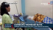 Cemburu, Suami Siram Istri Dan 2 Anak Dengan Air Keras