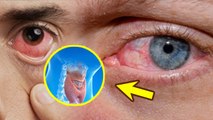 Diseases Signs in Eyes: आंखों से बीमारियों का पता लगाने का तरीका, Blood Sugar, Thyroid To Cancer
