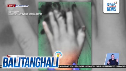 24 firecracker-related incidents, naitala sa East Ave. Medical Center | Balitanghali