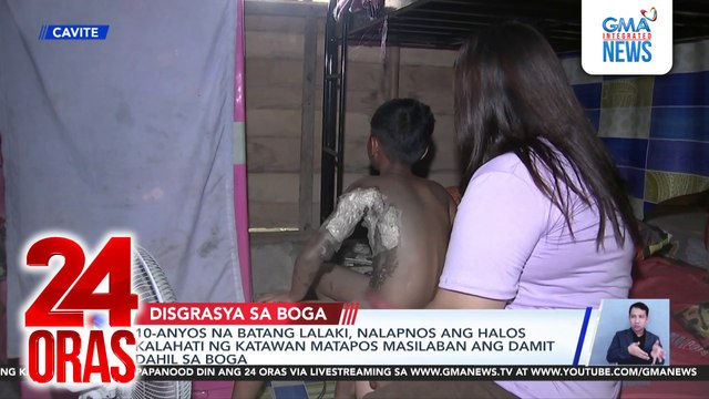 10-anyos na batang lalaki, nalapnos ang halos kalahati ng katawan matapos masilaban ang damit dahil sa boga | 24 Oras