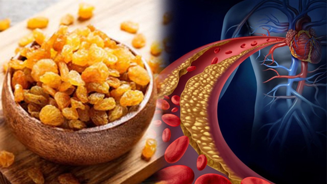 Raisin In High Cholesterol: हाई कोलेस्ट्रॉल में किशमिश खाने के फायदे ,  Benefits In Hindi | Boldsky