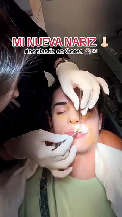 Pues no me termina de gustar vlog jamescorea rinoplastia cirugiaplastica jamescirugia