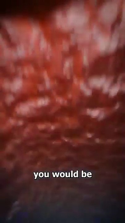 What Happens if Swallowed by sperm whale