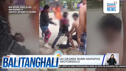 Bata, nagtamo ng 2nd-degree burn matapos magliyab ang isang motorsiklo | Balitanghali