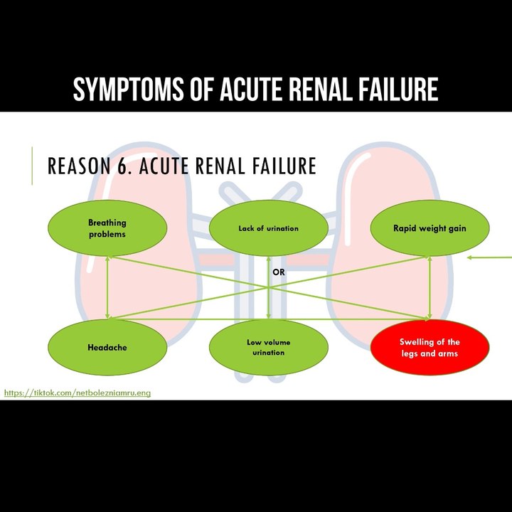 Symptoms of acute renal failure #kidneys #renaldisease