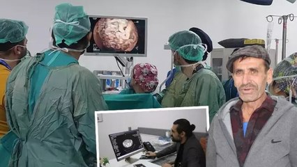 Yemekten sonra karnı şişip kusuyordu, 10 kattan fazla büyüyen midesi herkesi şaşırttı