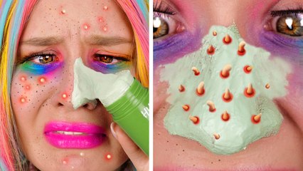 Tired of Pimples?! 😱 Potato Hack That Works! 🥔 #123go