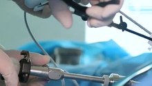 مضاعفات علاج تضخم البروستات بالجراحة أو المنظار