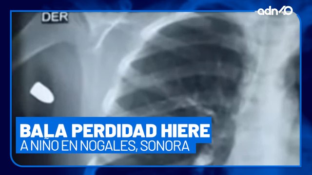 Menor de 8 años herido de bala en Sonora, estaba festejando el año nuevo cuando le dieron