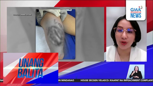 Panayam kay Dr. Zharlah Gulmatico-Flores, Chief, Medical and Professional Services, JRRMMC | Unang Balita