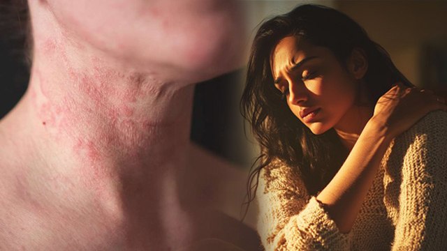 सोते समय शरीर में खुजली क्यों होती है|Itching During Sleep Causes & Treatment| Boldsky