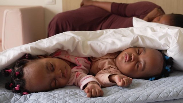 Côte d’Ivoire : séparation réussie de sœurs siamoises après 17 heures d'opération