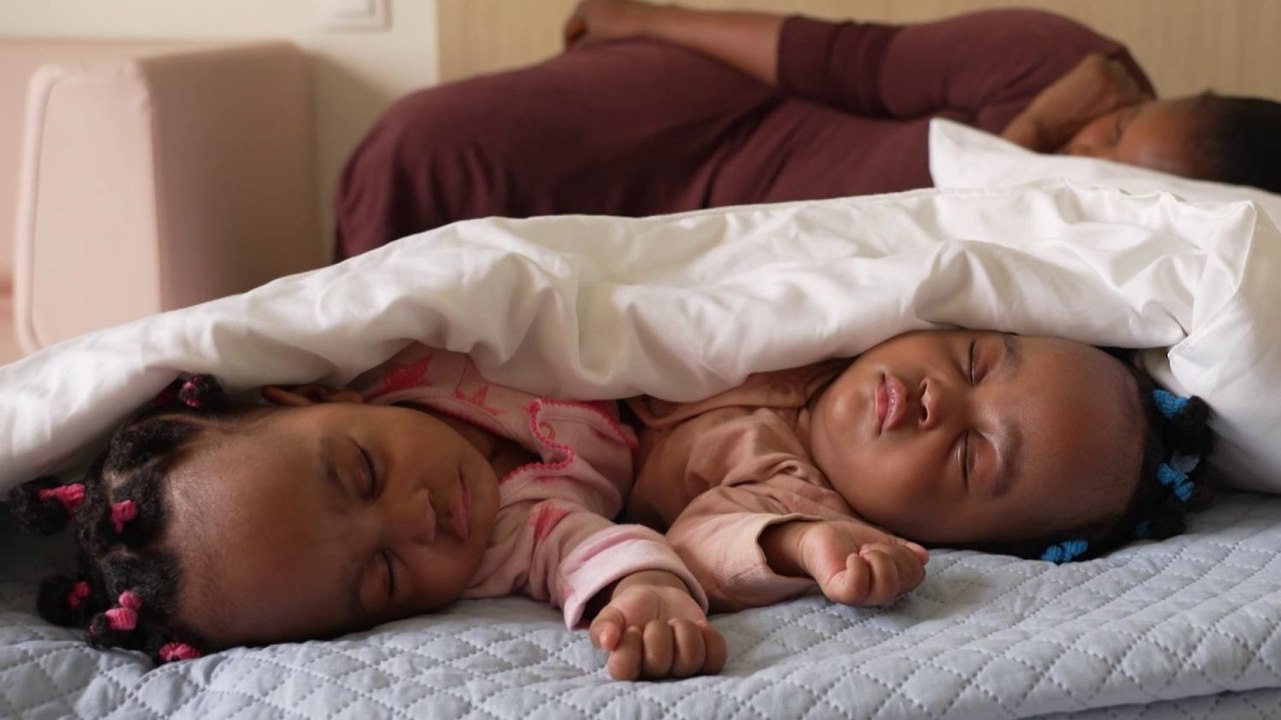 Côte d’Ivoire : séparation réussie de sœurs siamoises après 17 heures d'opération