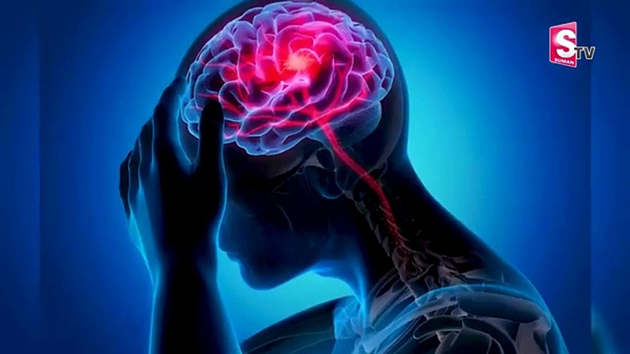 Understanding Types of Brain Stroke: Causes, Symptoms & Treatments | Dr. Raveesh | Arete Hospitals