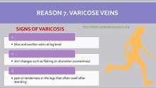 Varicose veins - a cause of edema