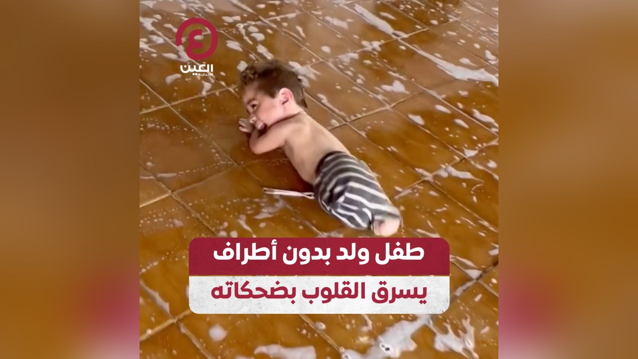 طفل ولد بدون أطراف يسرق القلوب بضحكاته