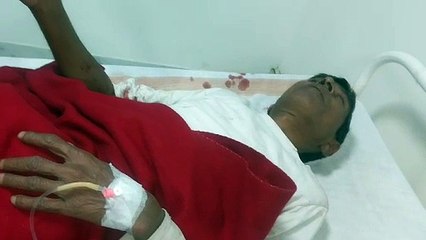 अजगर सांप से खेलना पड़ा महंगा