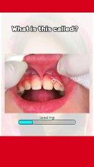 Unique Human body features Vocabulary